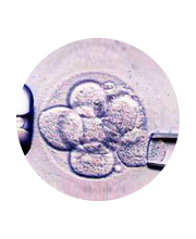 胚胎移植